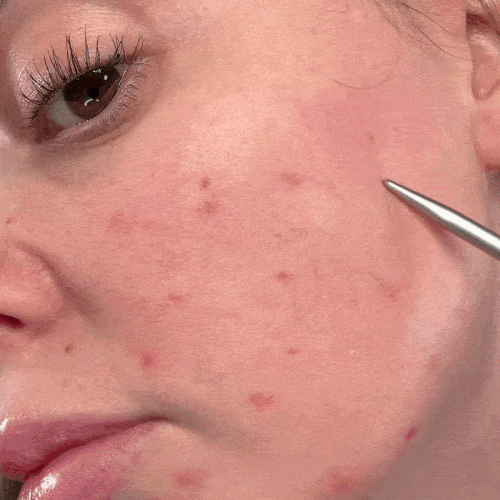 Ser Corector Glow Serum